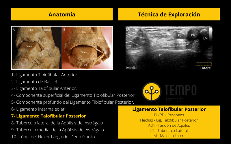 Ligamento Talofibular Posterior.png